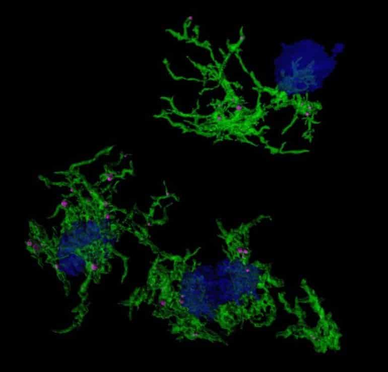 This shows microglia