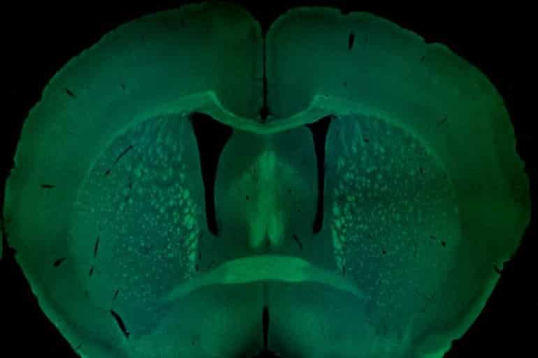 This shows a cross section of a mouse brain