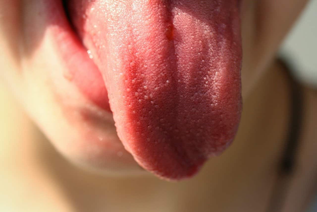 This shows a tongue