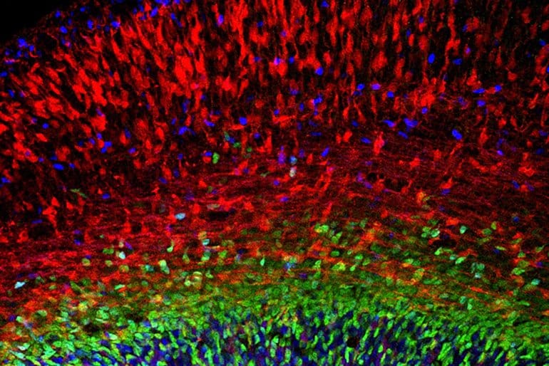 This shows the developing cerebral cortex of a mouse