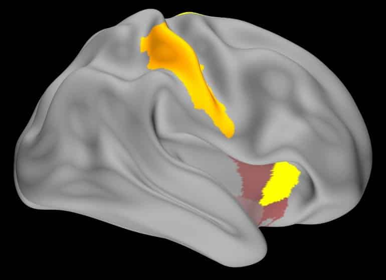 This shows brain scans from the study