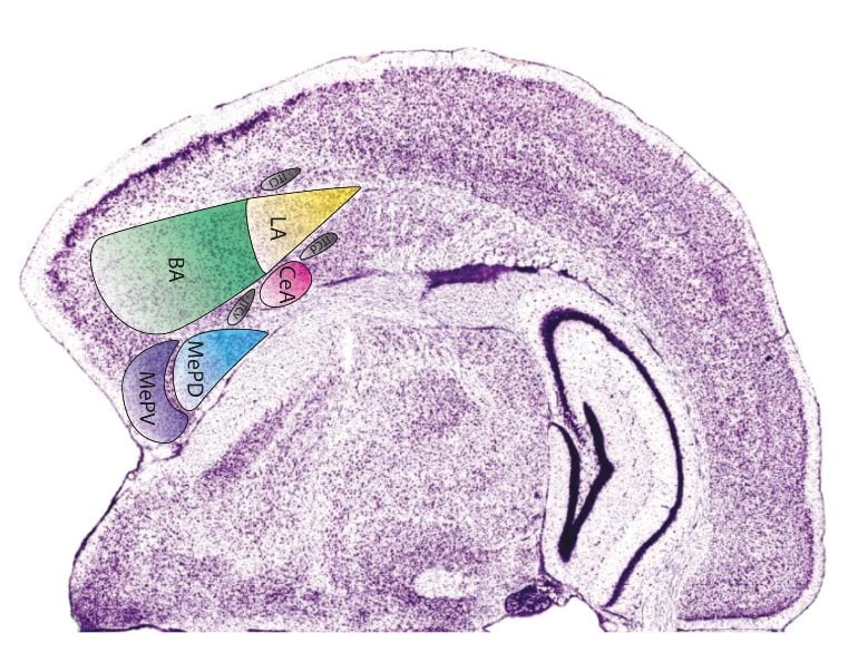 This is a brain slice with the amgydala highlighted