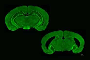 This shows two brain slices. One has a hippocampus, the other does not