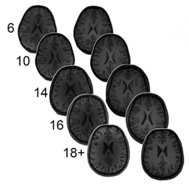 This shows brain scans from the study