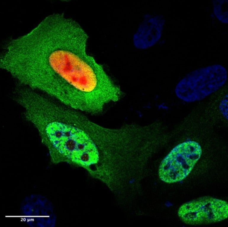 This shows the daxx protein