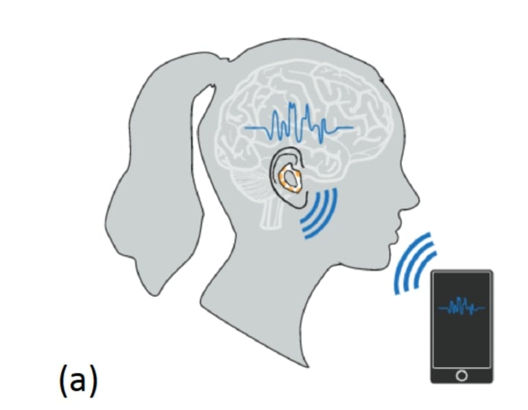 This is a diagram from the study