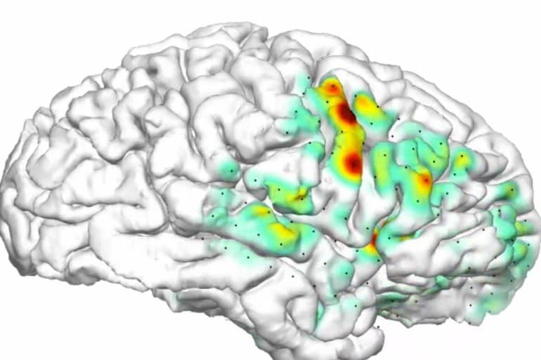 This shows the heatmap overlaid on a brain image