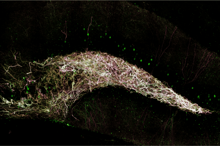 This shows neurons in the dentate gyrus