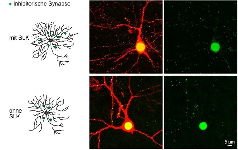 This shows dendrites