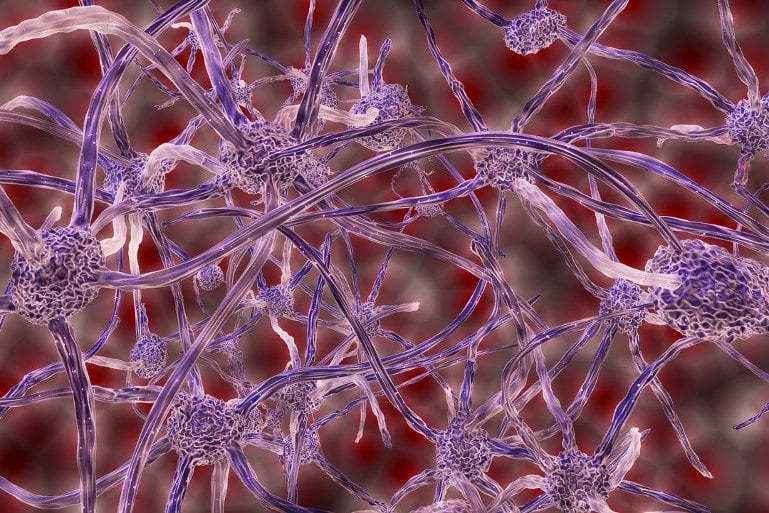 This is an artist rendition of neurons