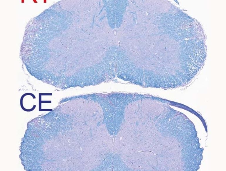 This shows a cross section of a spinal cord