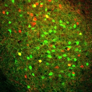 This shows neurons in the basolateral amygdala