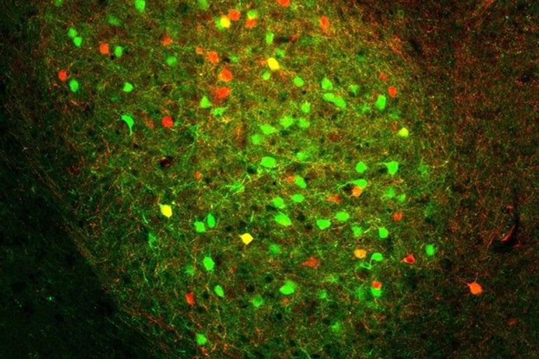 This shows neurons in the basolateral amygdala