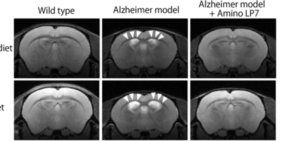 This shows brain scans from the study