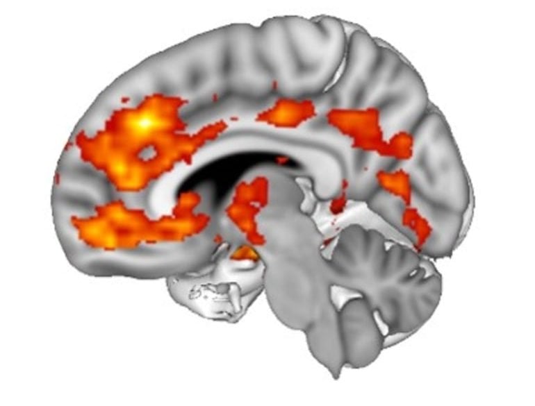 Brain wrinkles and folds matter – researchers are studying the mechanics of  how they form