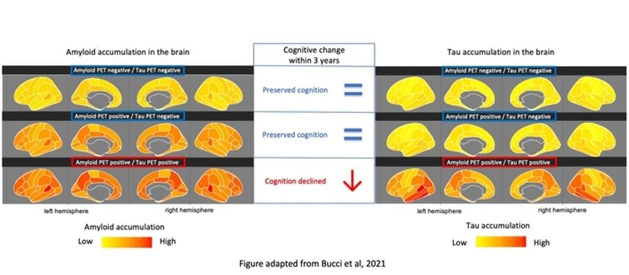 This shows brain scans from the study