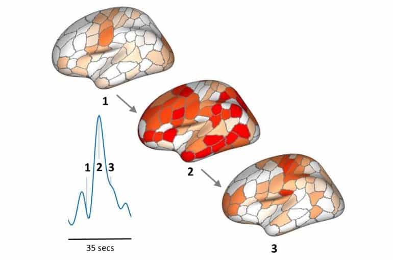 This shows brain scans from the study