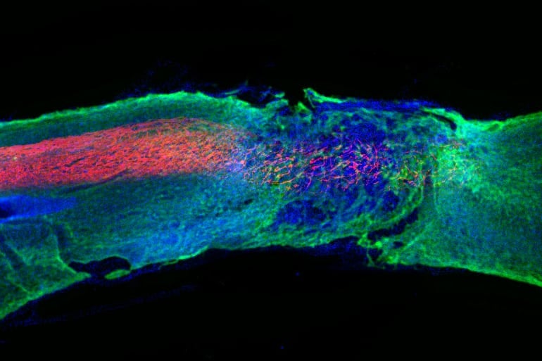 This shows regenerated axons in the spinal cord