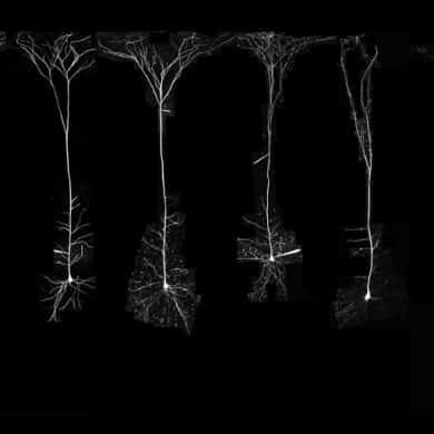 This shows pyramidal neurons from different animals and a human