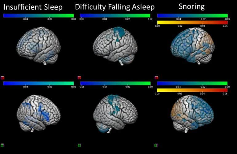 Your child's sleep affects their brain