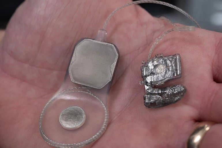 This shows the components of the bionic eye on a person's hand