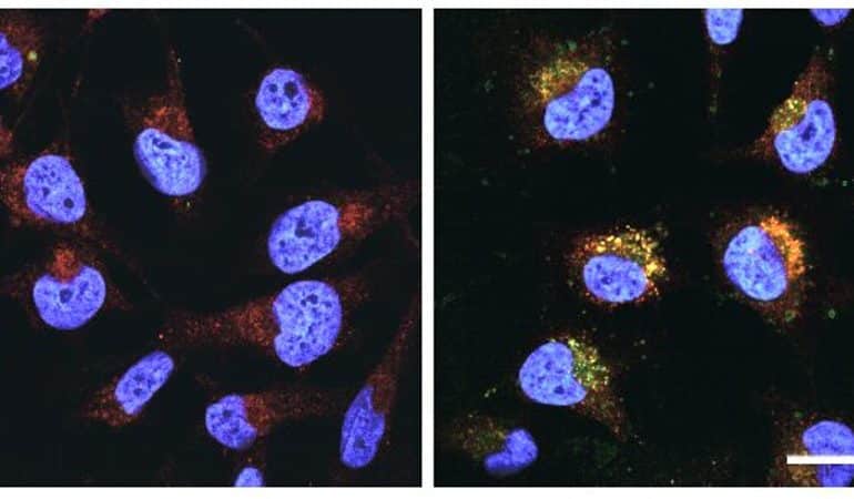 This shows long chain lipids