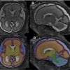 This shows the fetal brain scans