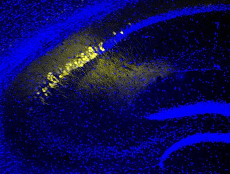 This shows neurons in the hippocampus