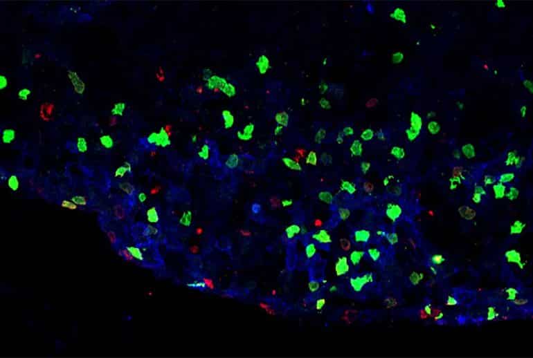 This shows the inflammatory lesions in a mouse spinal cord