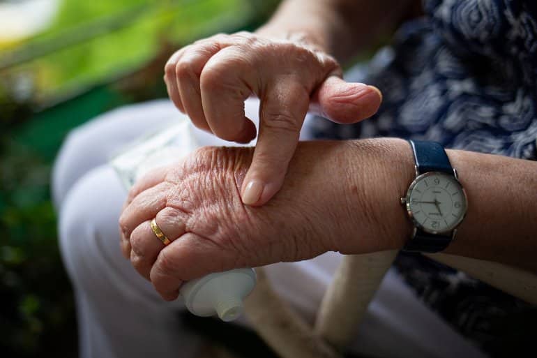 This shows a woman rubbing cream into her arthritic hand