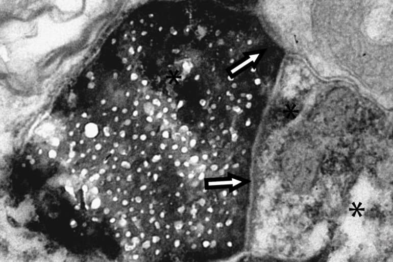 This shows proteins in the retinal cells