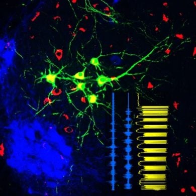 This shows spincerebellar neurons