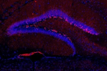 This shows a hippocampal slice