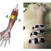 This indicates a hand covered with electrodes
