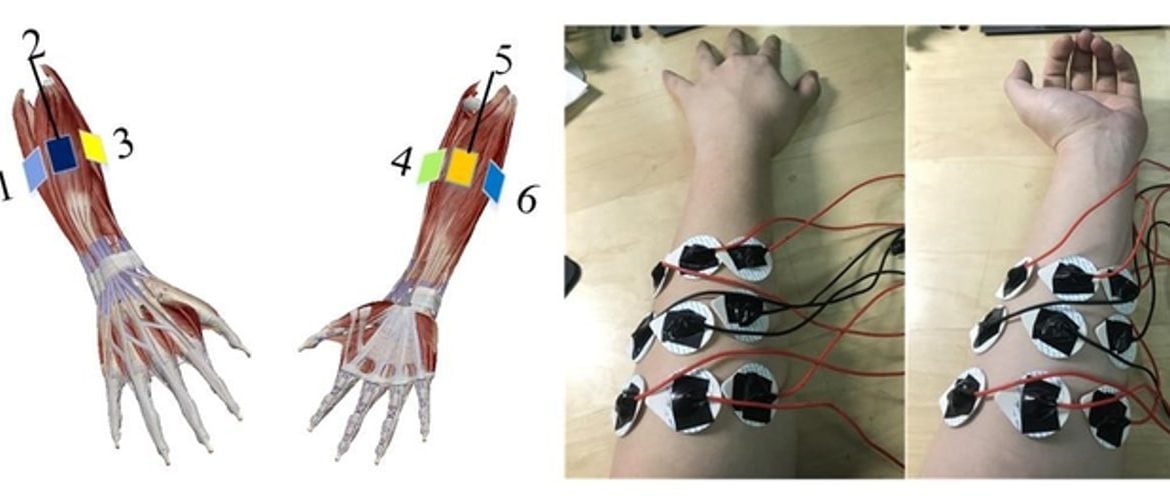 This shows an arm covered in electrodes