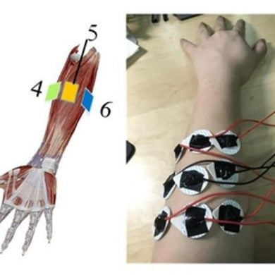 This shows an arm covered in electrodes