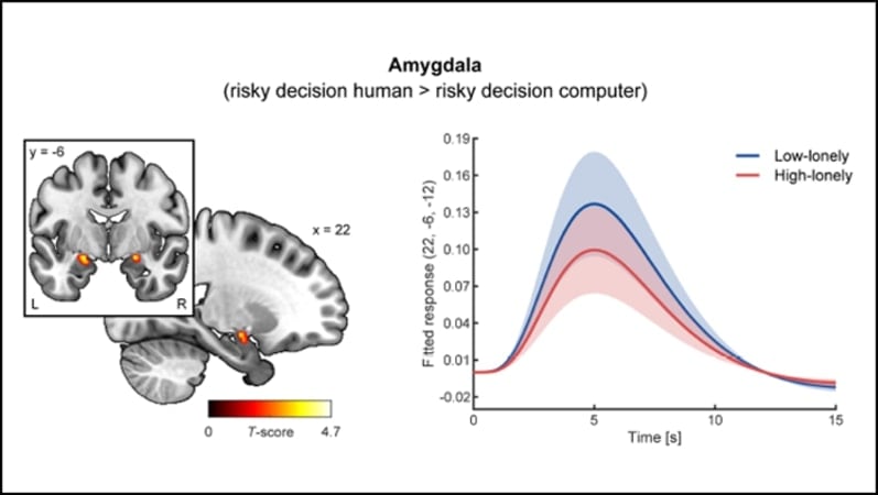 This shows a graph and the location of the amygdala in the brain