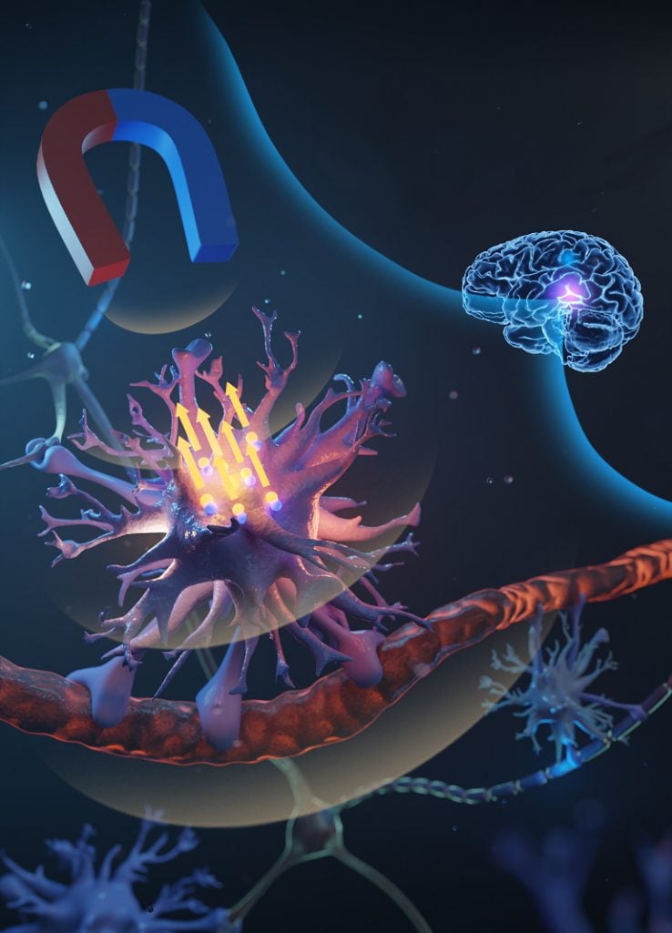 This illustration shows a magnet controlling neurons
