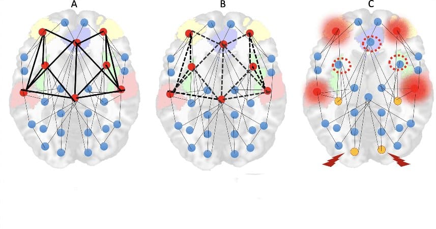 This shows connectivity areas in the brain