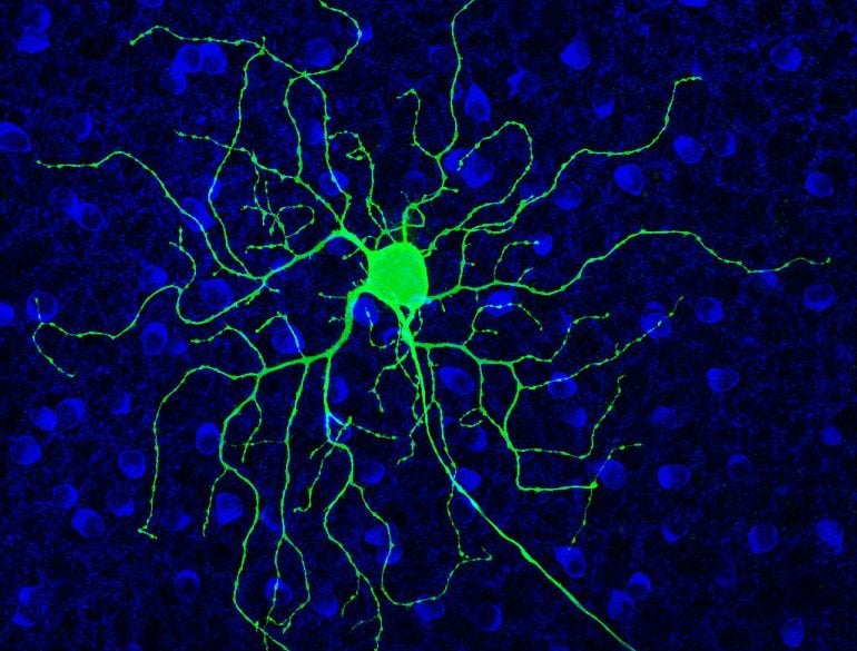 This shows a retinal ganglion cell