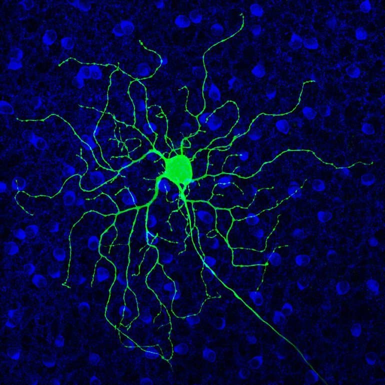 This shows a retinal ganglion cell