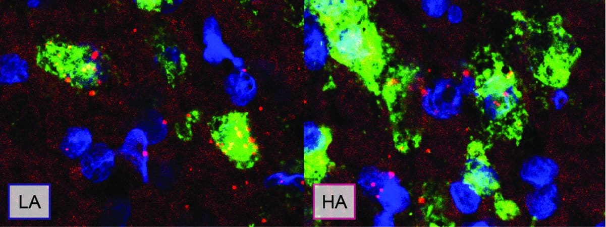 This shows dopamine neurons