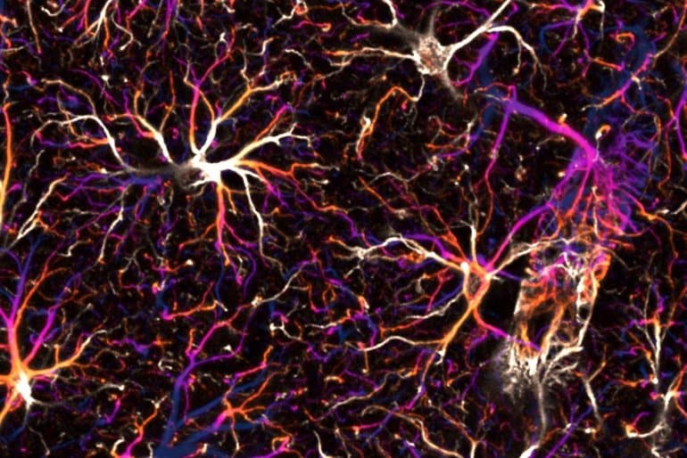 This shows astrocytes