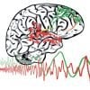 This shows a drawing of a brain with squiggles showing the communication deficits
