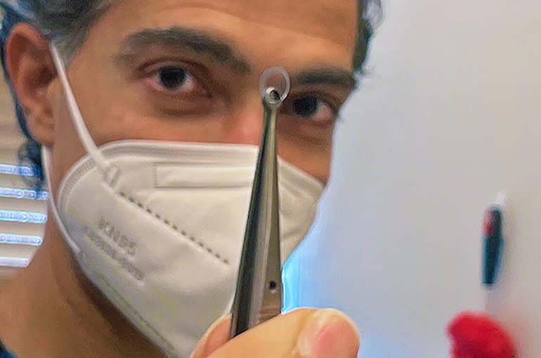 This shows the researcher holding up his plastic "window" with a tweezers