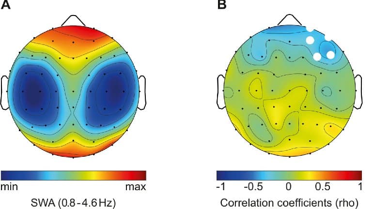 This shows eeg readouts from the study