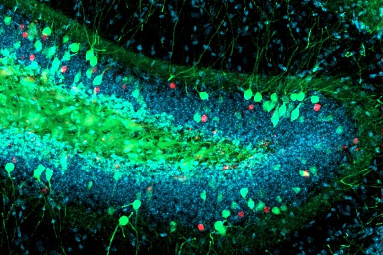 This shows the hippocampus and neurons