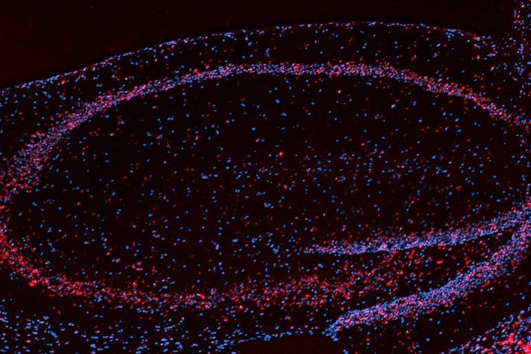 This shows hippocampal neurons