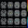This shows different brain scans