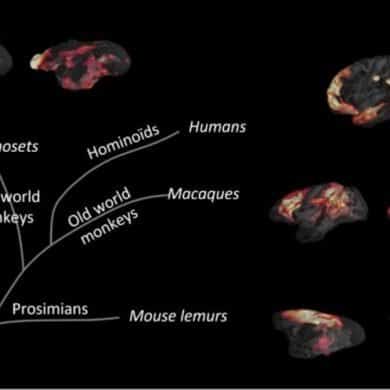 This shows brain scans of different monkeys